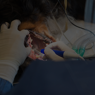 Dental Scaling