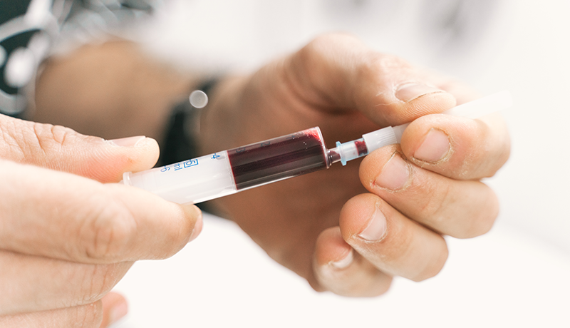 Blood Sample Serology Testing